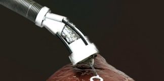 3D-печать внутри тела становится возможной благодаря новому типу гибкой роботизированной руки | New-Science.ru 3D-печать внутри тела становится возможной благодаря новому типу гибкой роботизированной руки | New-Science.ru