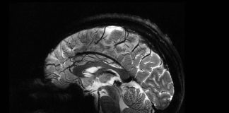 Самый мощный в мире магнитно-резонансный томограф делает первые снимки | New-Science.ru Самый мощный в мире магнитно-резонансный томограф делает первые снимки | New-Science.ru