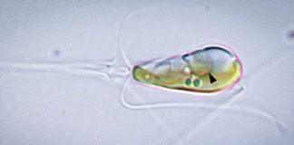 Открыта новая форма жизни, возникшая в результате слияния бактерии с водорослью | New-Science.ru Открыта новая форма жизни, возникшая в результате слияния бактерии с водорослью | New-Science.ru