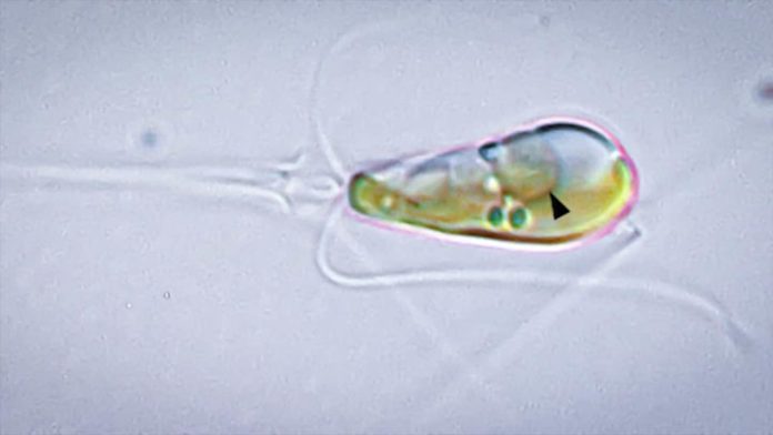 Открыта новая форма жизни, возникшая в результате слияния бактерии с водорослью | New-Science.ru