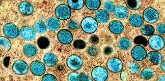 Обезьянья оспа: ВОЗ объявляет чрезвычайную ситуацию в области здравоохранения | New-Science.ru Обезьянья оспа: ВОЗ объявляет чрезвычайную ситуацию в области здравоохранения | New-Science.ru