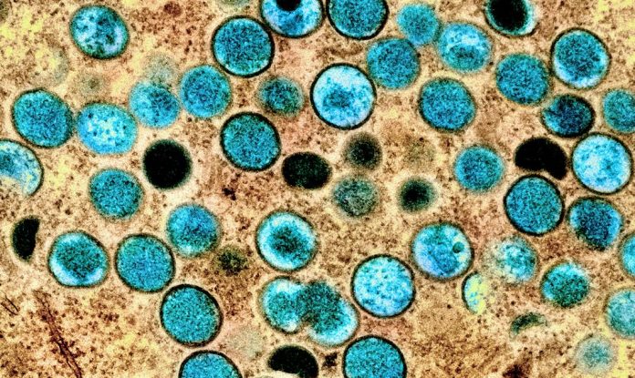 Обезьянья оспа: ВОЗ объявляет чрезвычайную ситуацию в области здравоохранения | New-Science.ru