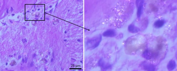 Учёные обнаружили микропластик в мозге, но его влияние на здоровье пока неясно | New-Science.ru