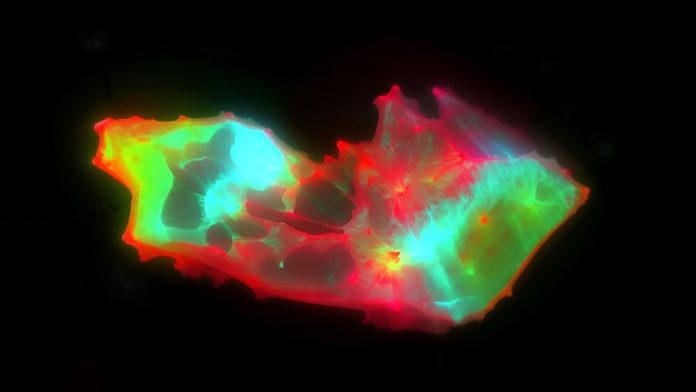 В крови пациентов с длительным COVID обнаружены аномальные микроструктуры | New-Science.ru