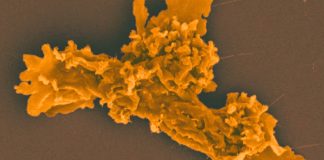 Жизнь в кипятке: открыта амеба, меняющая представления о пределах выживания | New-Science.ru Жизнь в кипятке: открыта амеба, меняющая представления о пределах выживания | New-Science.ru