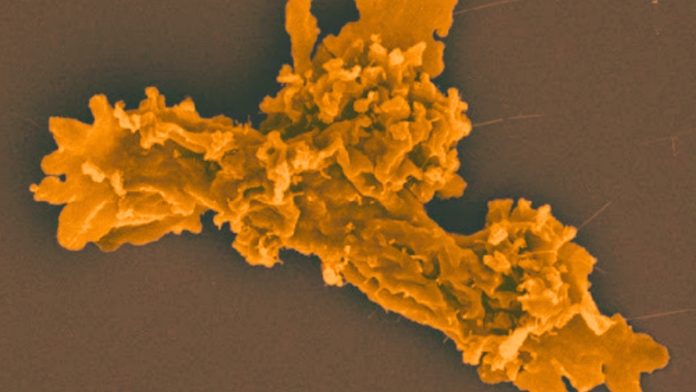 Жизнь в кипятке: открыта амеба, меняющая представления о пределах выживания | New-Science.ru