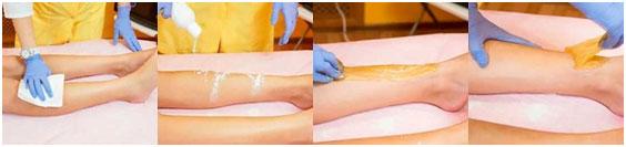 grocedura-shugaringa